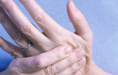 Чому кілька пальців на руці можуть несподівано побіліти