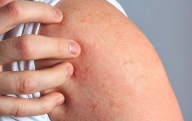 Дефіцит вітаміну B12: на нього вказує 