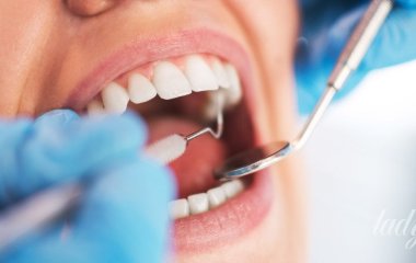 Навіщо нам зуби мудрості: вчені пояснили еволюційну загадку та чому вони стали проблемою