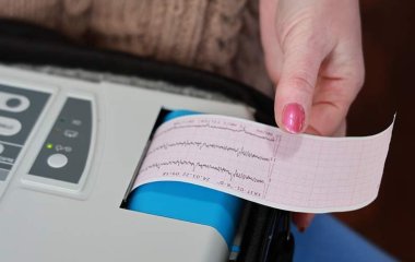 Кардіолог розповів про симптоми серцевої недостатності