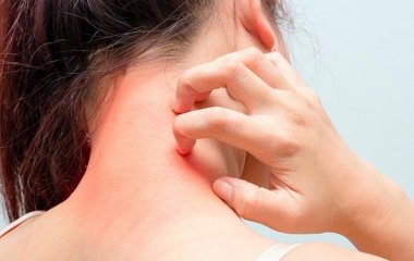 Медики розповіли як уберегтися від шкірних захворювань