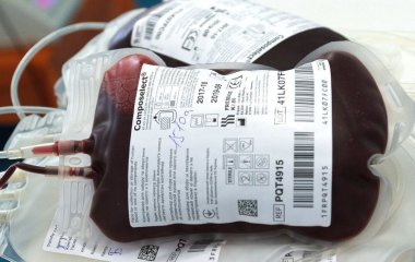 Чи може Альцгеймер передаватися через переливання крові: вчені попередили про можливий ризик