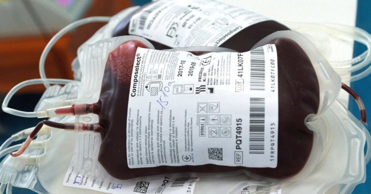Чи може Альцгеймер передаватися через переливання крові: вчені попередили про можливий ризик