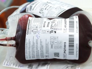 Чи може Альцгеймер передаватися через переливання крові: вчені попередили про можливий ризик