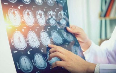 Ученые сделали важное открытие о болезни Альцгеймера