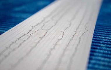 Медики обнаружили неожиданную причину инсультов