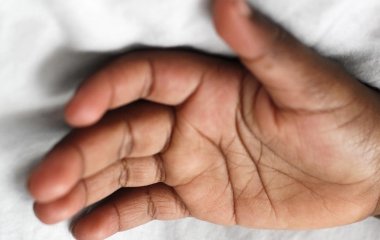 Вічно холодні руки – лікар розповів про можливі патології