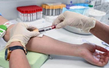 Гематолог дав рекомендації щодо профілактики тромбозу
