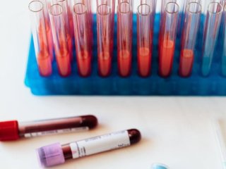 Стрес фізично змінює структуру крові: вчені з’ясували, як це відбувається