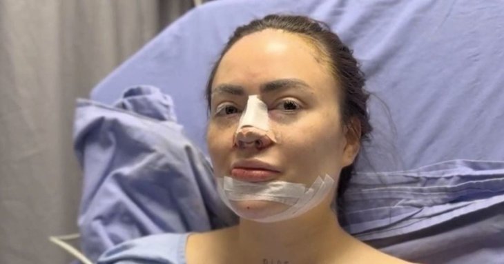 Лікарі знайшли взуттєву гуму в підборідді відомої блогерки – фото
