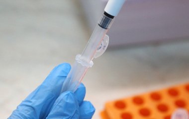 Стовбурові клітини змогли перетворити на клітини кістки за допомогою звуку
