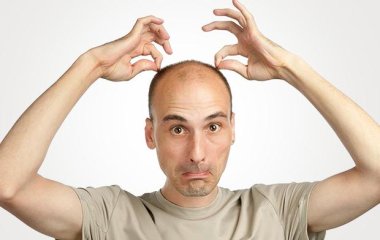 Вчені виявили новий спосіб боротися з облисінням