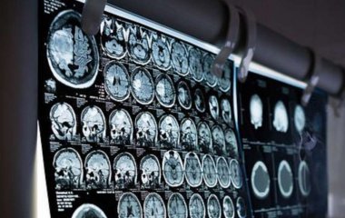 Ученые обнаружили новую важную функцию одной из части человеческого мозга