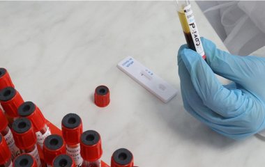 Фахівець розповів про симптоми омікрону у дітей