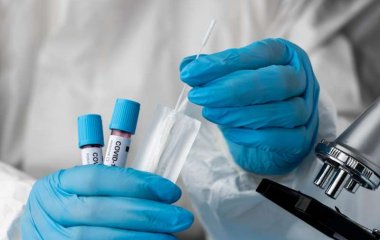 Невролог пояснив, чому госпіталізують хворих на ковід у легкій формі