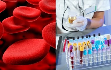 Знайдено біомаркер важкої форми коронавірусу