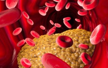 Як знизити високий рівень холестерину: 5 способів, які пропонують експерти