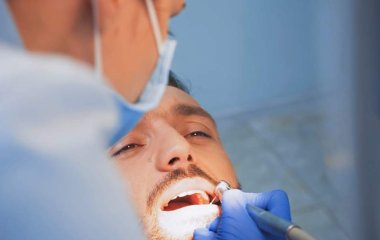 Стоматолог назвала небезпечні причини кровоточивості ясен