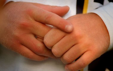 Невеликий слід на пальці може бути ознакою смертельної хвороби (фото)