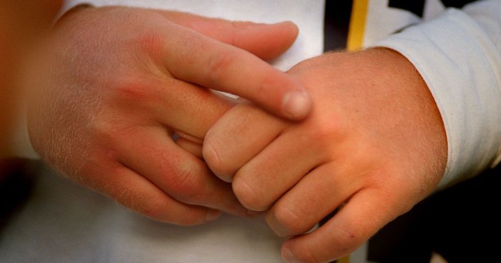 Невеликий слід на пальці може бути ознакою смертельної хвороби (фото)