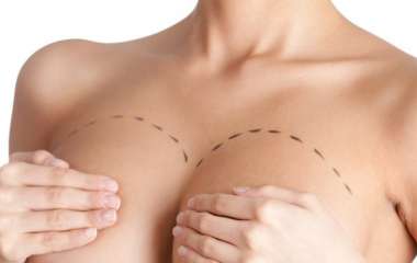 Пластические операции на груди: Правильный подход - отличный результат