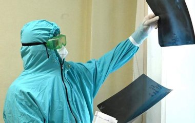 Терапевт назвав категорію важче людей, які переносять «Омікрон» людей