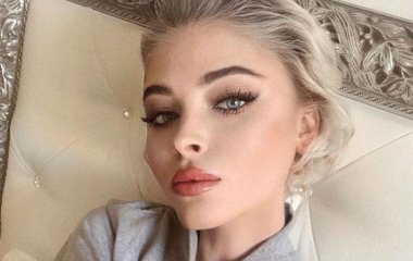 ШОК! Алена Шишкова призналась, что облысела