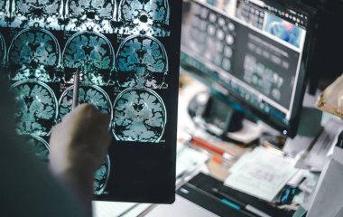 Постійні негативні думки пов'язали з ризиком отримати хворобу Альцгеймера
