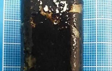 Чоловік прожив 30 років із запальничкою у шлунку — вона досі працювала
