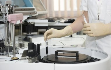 Вчені розробили експрес-тест для виявлення хвороби Альцгеймера
