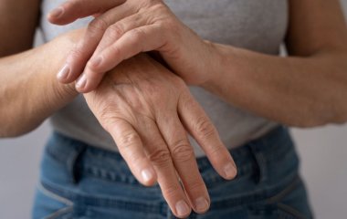Как по рукам определить, что у вас цирроз печени: основные признаки
