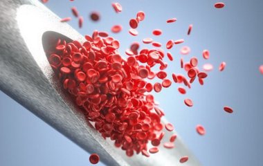 Як зрозуміти, що в організмі вже росте тромб: названо три симптоми
