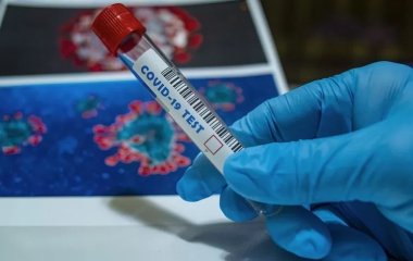 Лікар розповів, які аналізи треба здати після коронавірусу