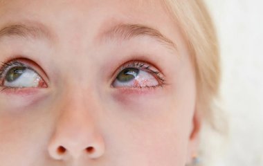 Ученые выяснили, как цвет глаз влияет на расположенность к заболеваниям