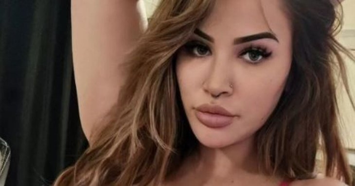 Жінка з 18-м розміром грудей шокувала рідкісним захворюванням: який вона має вигляд (фото)