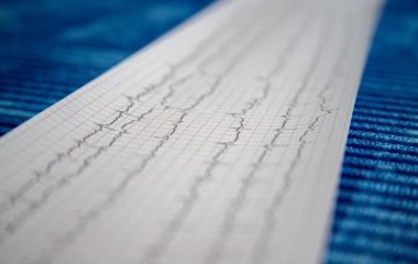 Ученые нашли способ, как повысить выживание при сердечном приступе