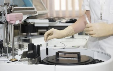 Вчені назвали спосіб зупинити поширення чотирьох видів раку