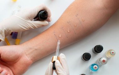 Эти витамины помогут облегчить симптомы аллергии