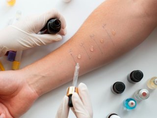 Эти витамины помогут облегчить симптомы аллергии