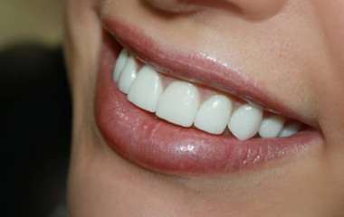 Как восстановить идеальное состояние зубов?