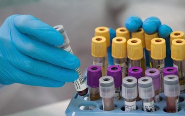 Вчені виявили зв'язок між групою крові та ризиком серцевого нападу