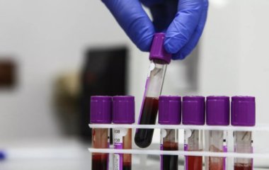 Названо п'ять факторів, що провокують небезпечний вид раку.