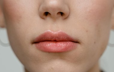 Безсоння та герпес: лікар пояснила особливості весняного авітамінозу