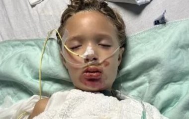 7-річна дівчинка опинилася в комі після вірусного челенджу TikTok: що вона зробила (фото)