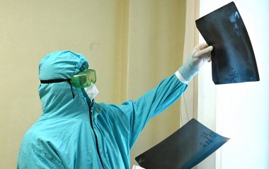 Розкрито смертельно небезпечні ускладнення після коронавірусу.
