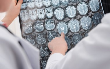 Названо 6 захворювань, що передаються у сім'ях по жіночій лінії.