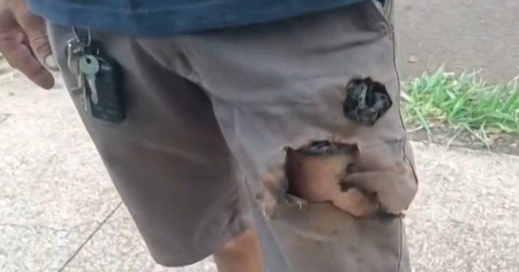 Чоловік вижив після нападу собак завдяки вибуху телефону — фото