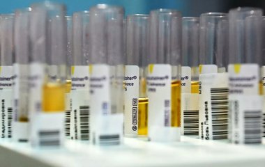 Ендокринолог розкрила несподівану властивість 