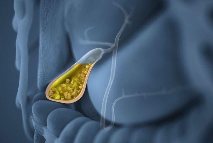 Уменьшает риски атеросклероза и камней в желчном пузыре: диетолог назвала невероятно полезный овощ