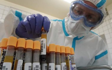 Лікар назвав ознаки повного одужання від коронавірусу